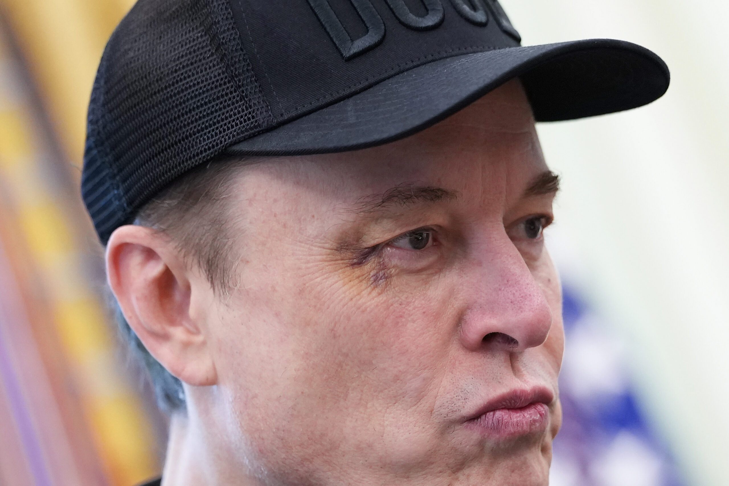 photo of Elon Musk with a black eye