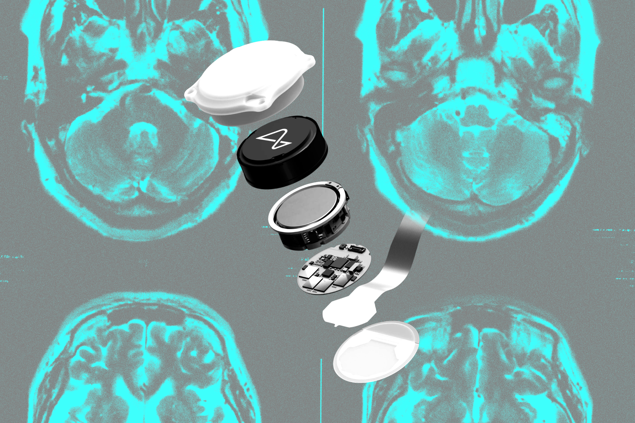 A collage of brain images and a Neuralink BCI implant.