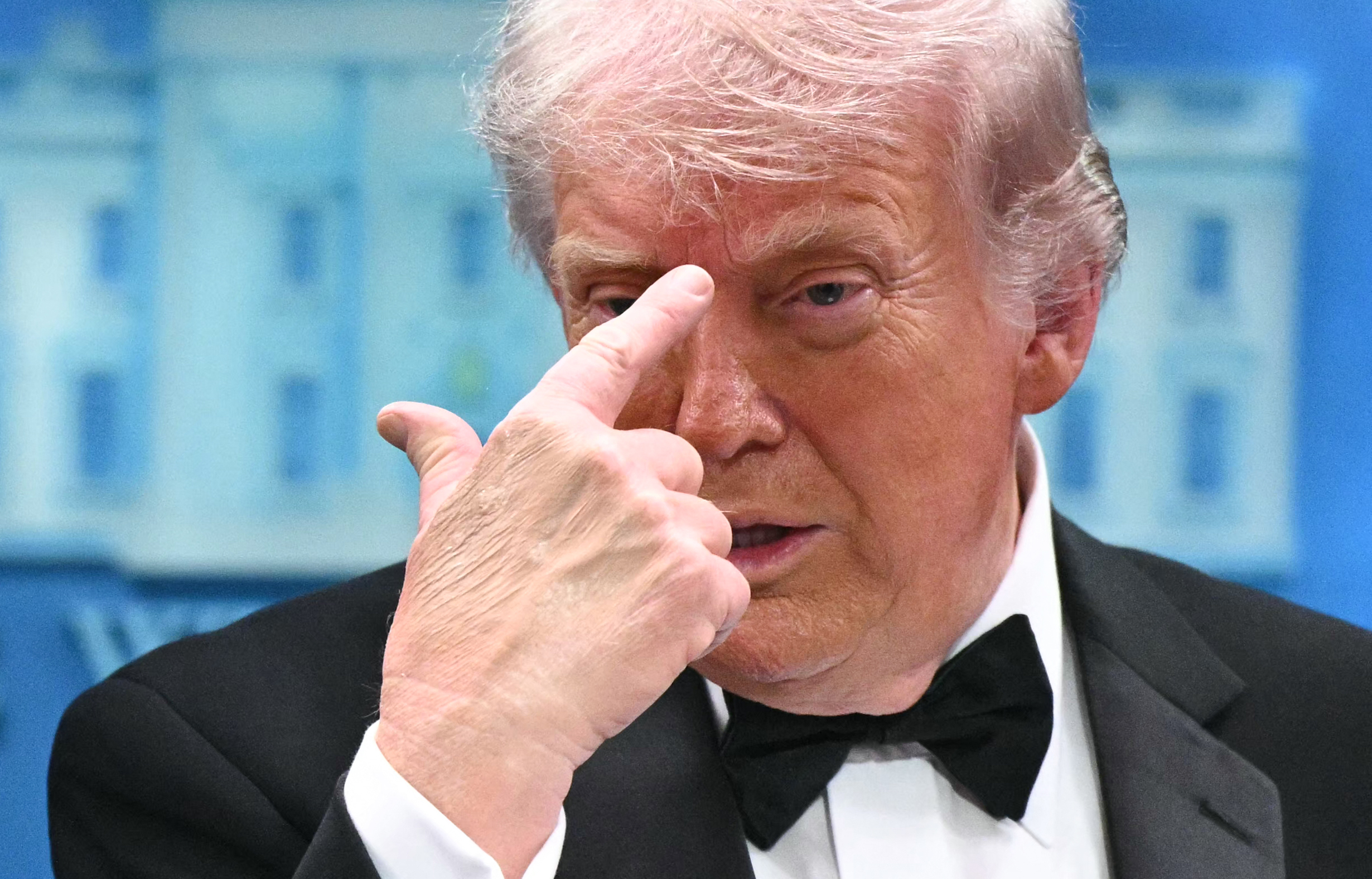 Donald Trump pointing at his forehead.