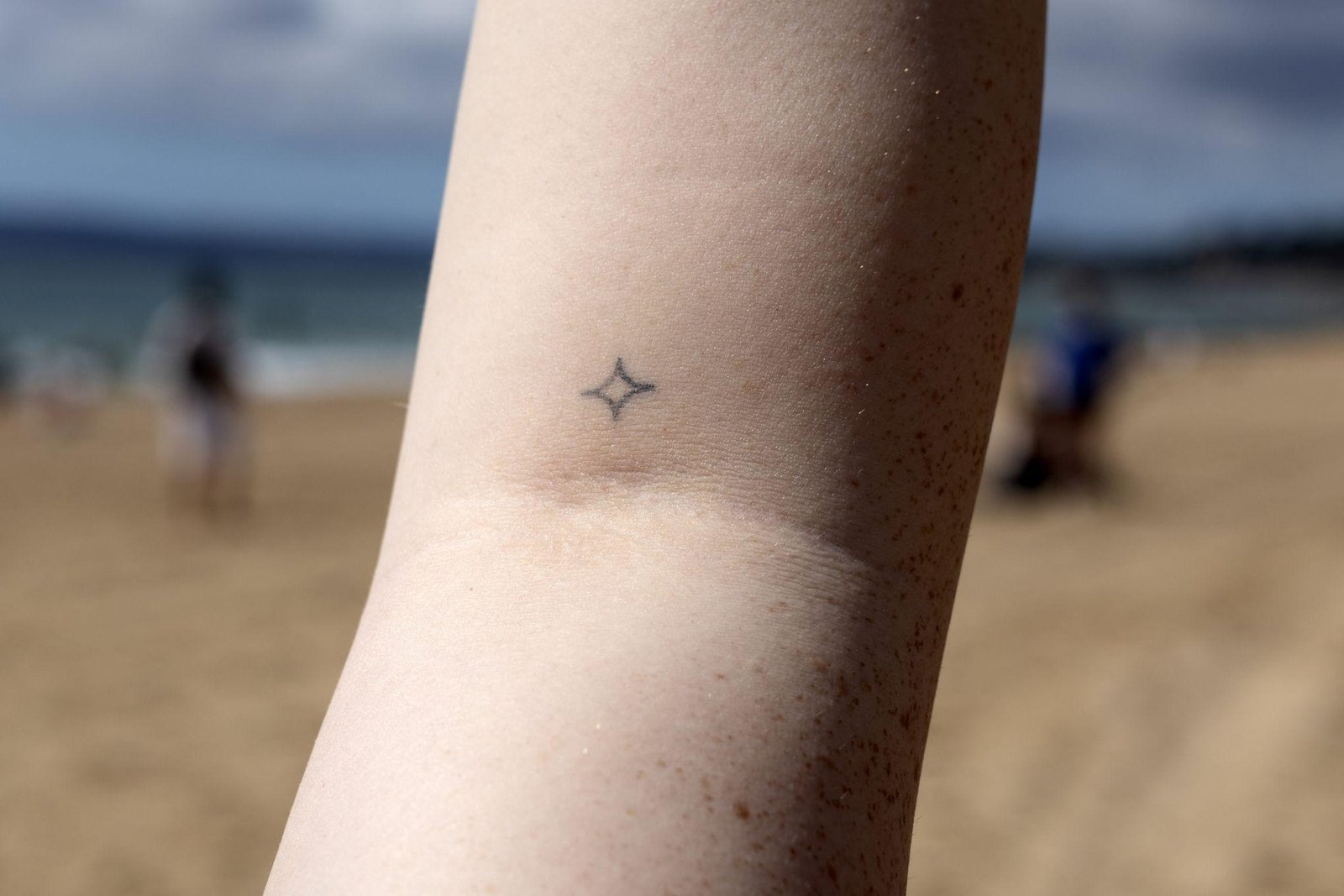 A photograph of a healed Microdot tattoo on someone’s arm, in a sparkle design.